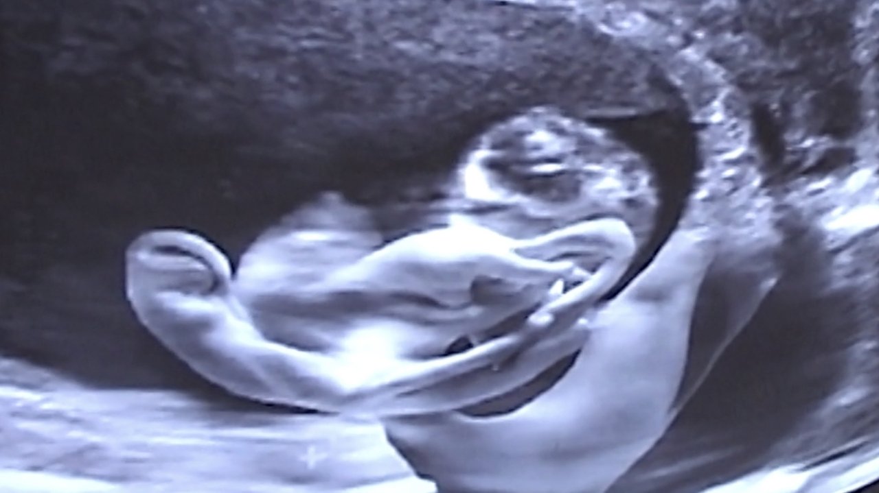 Castration Movie Anthology iii. Year of the Hyaena backdrop