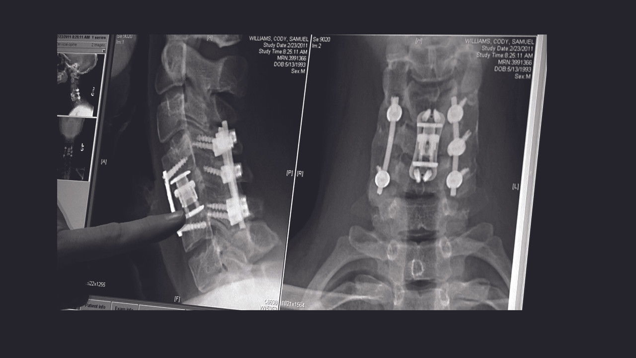 The Hill Chris Climbed: The Gridiron Heroes Story backdrop