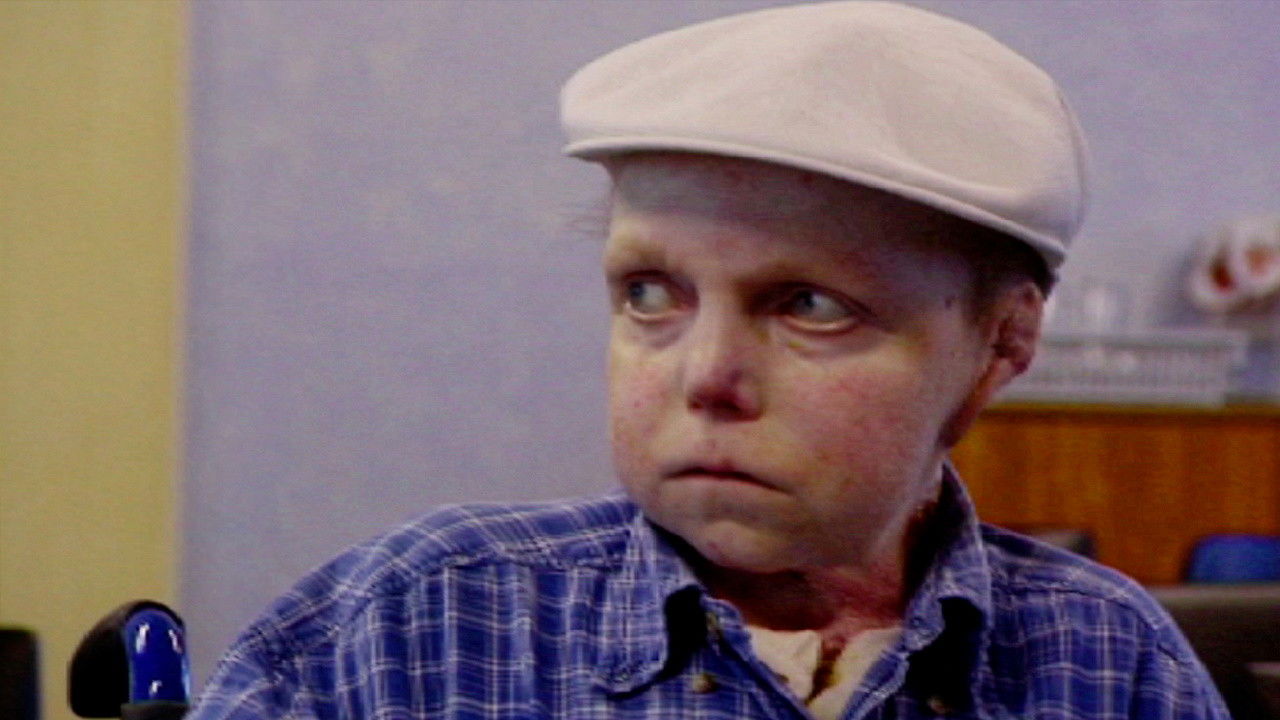 The Boy Whose Skin Fell Off backdrop