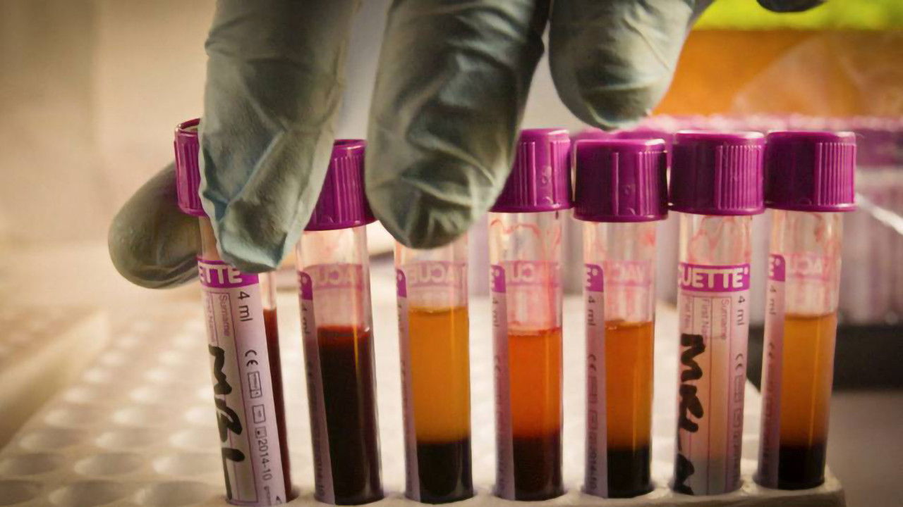 The Bloody Truth backdrop