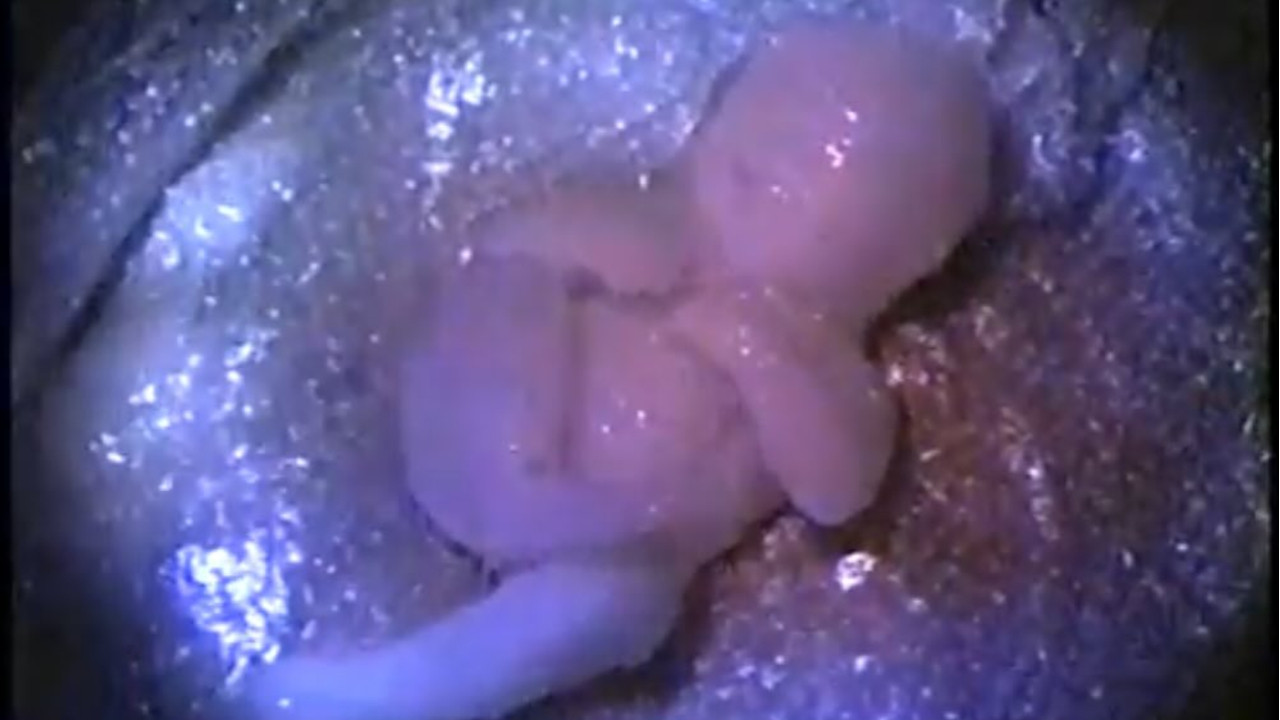 Busted Babies backdrop