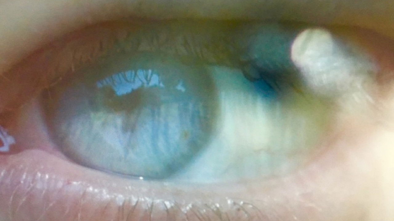 An Absence of Reciprocity in Vulnerability, Losses and Risks backdrop