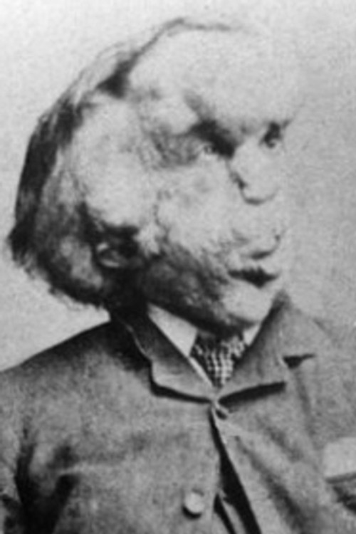 Joseph Merrick as 