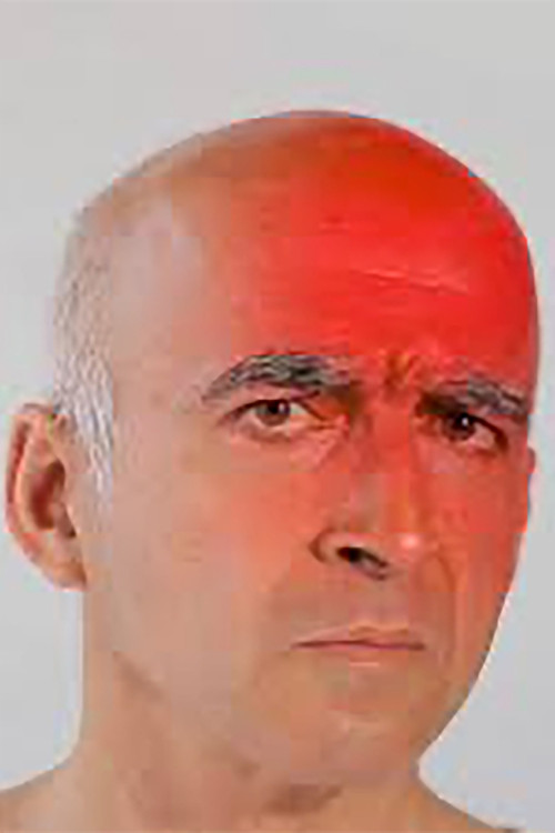 António Olaio as Paciente