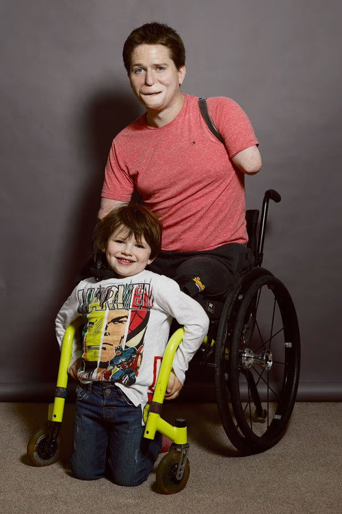 The Extraordinary Case of Alex Lewis