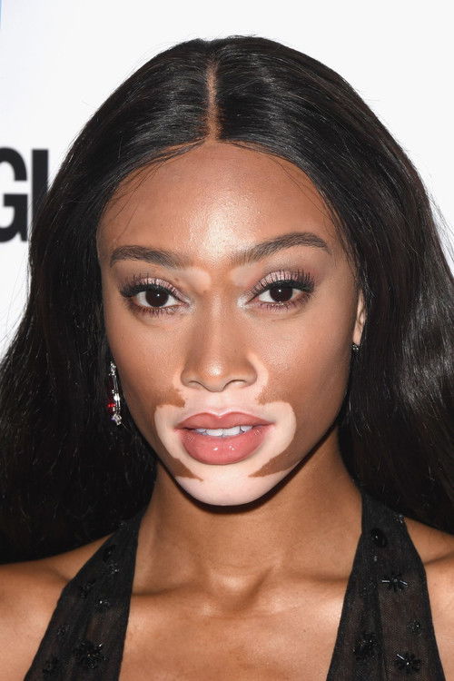 Winnie Harlow as Noni