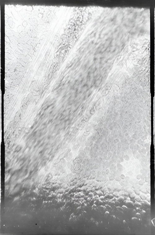 Déplacement des globules de sang dans un vaisseau capillaire poster