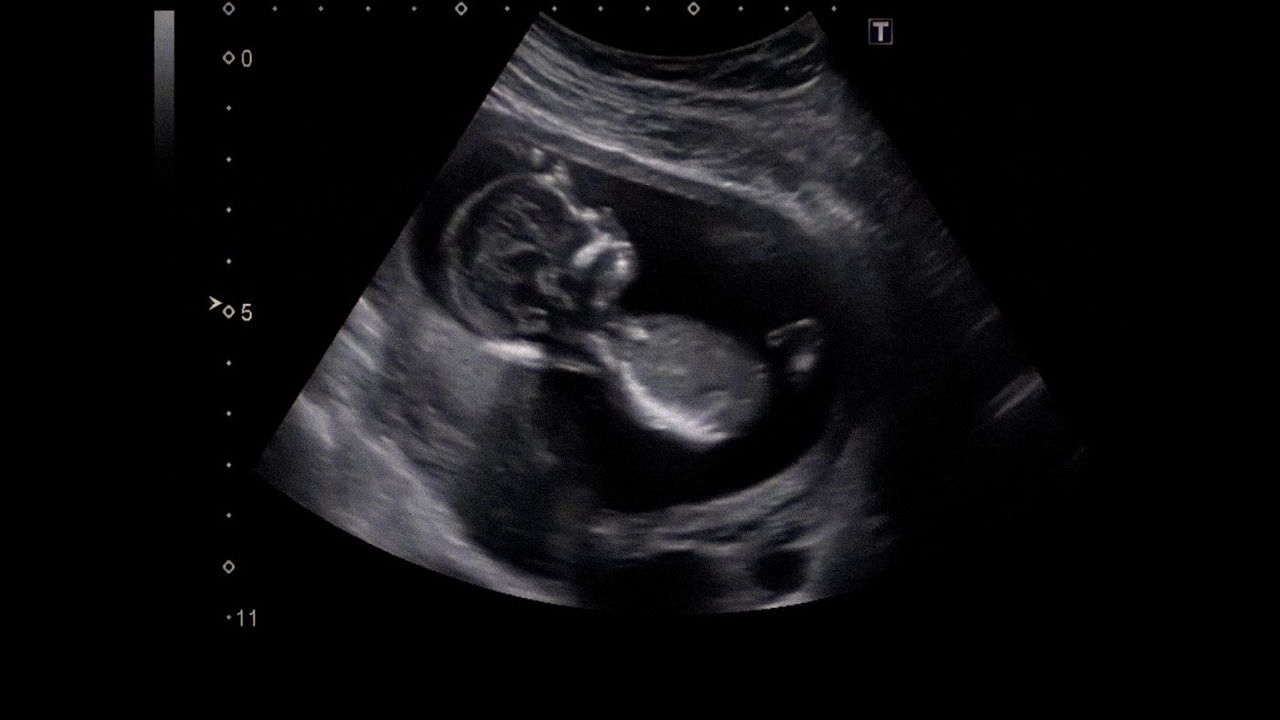 Foreign Bodies backdrop