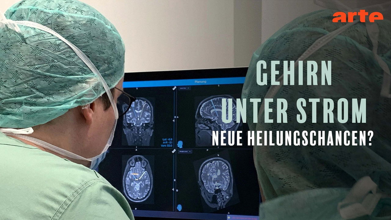 Gehirn unter Strom - Hilfe bei Depression, Epilepsie und Parkinson? backdrop