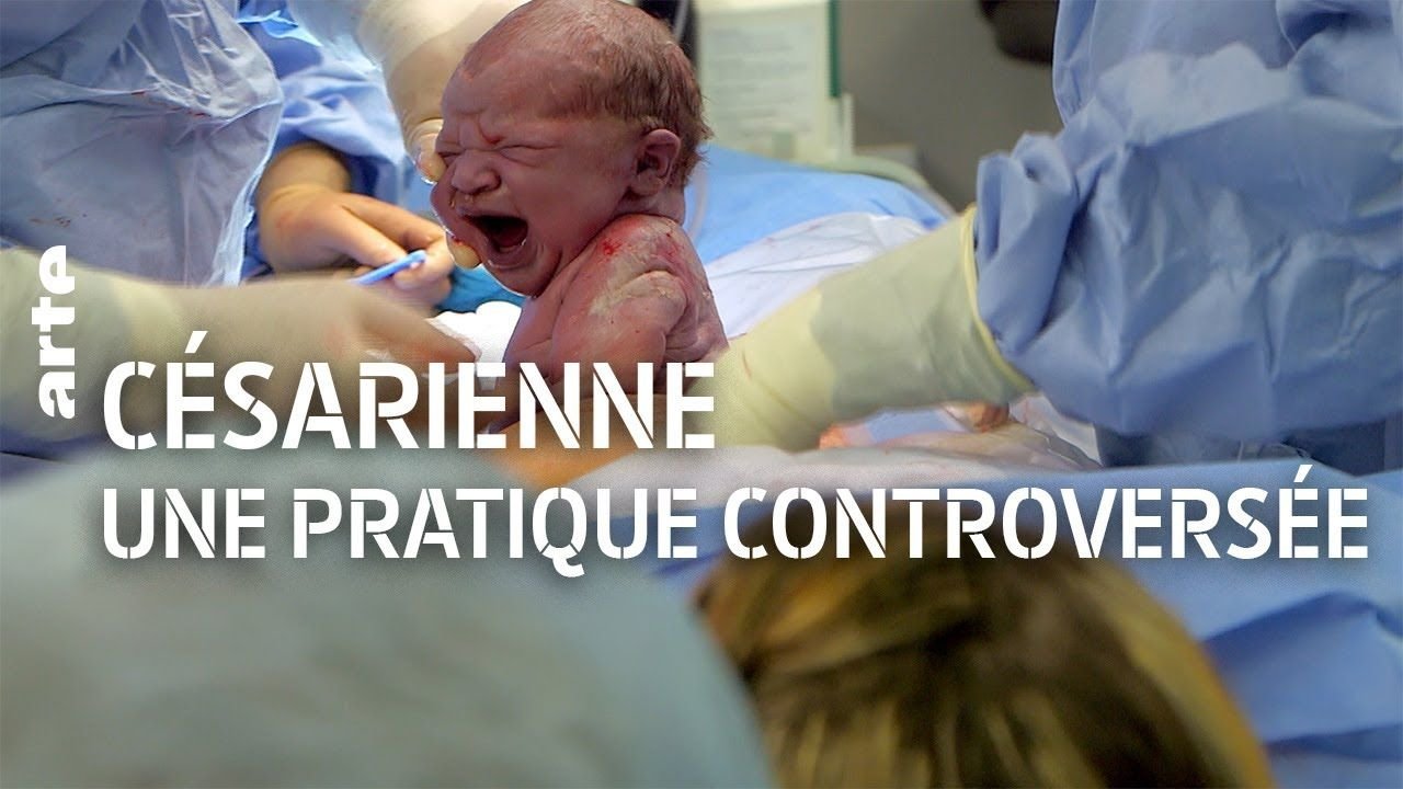 The C-Section Controversy backdrop